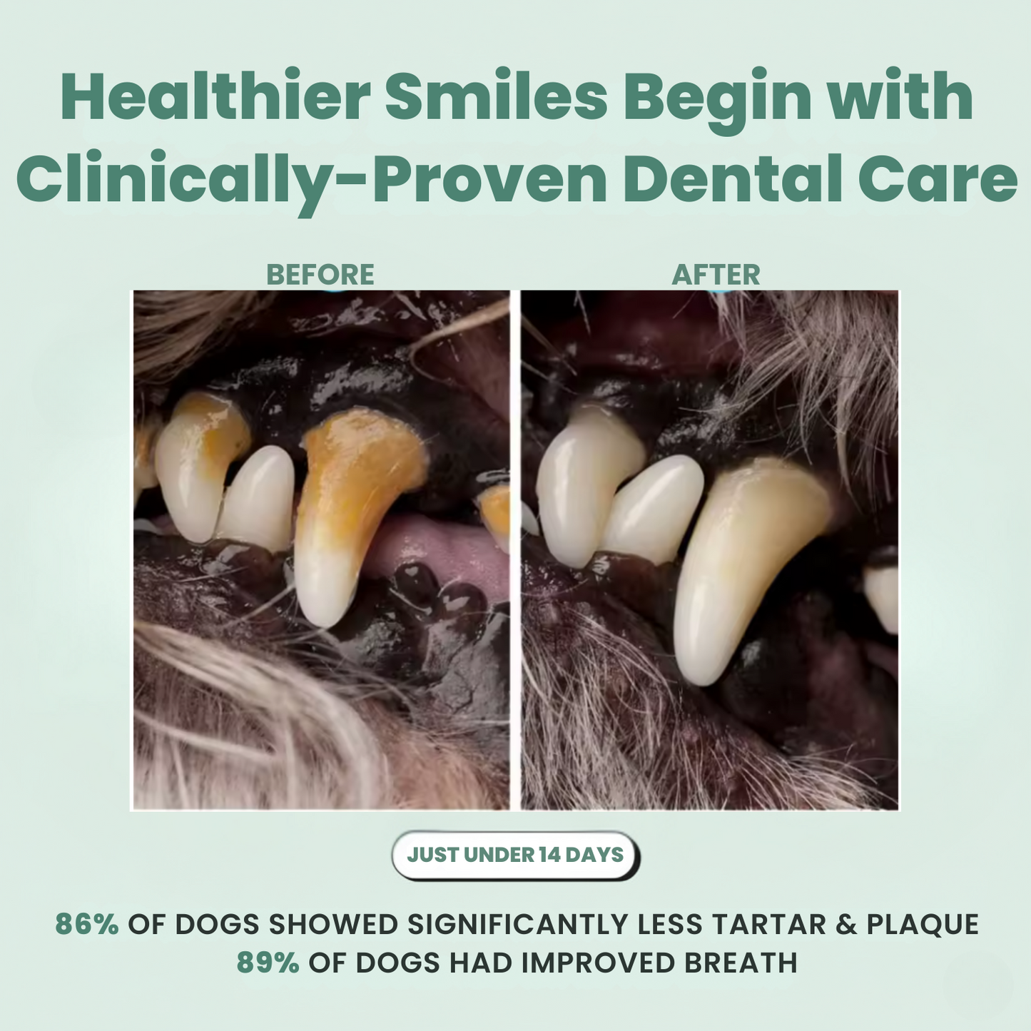Dental Cleaning Powder